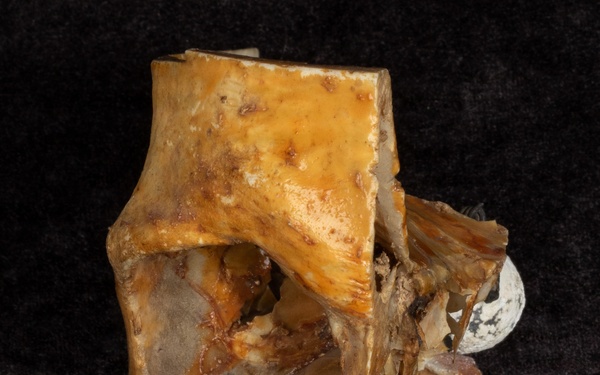 Battle of Fredericksburg Anatomical Specimen