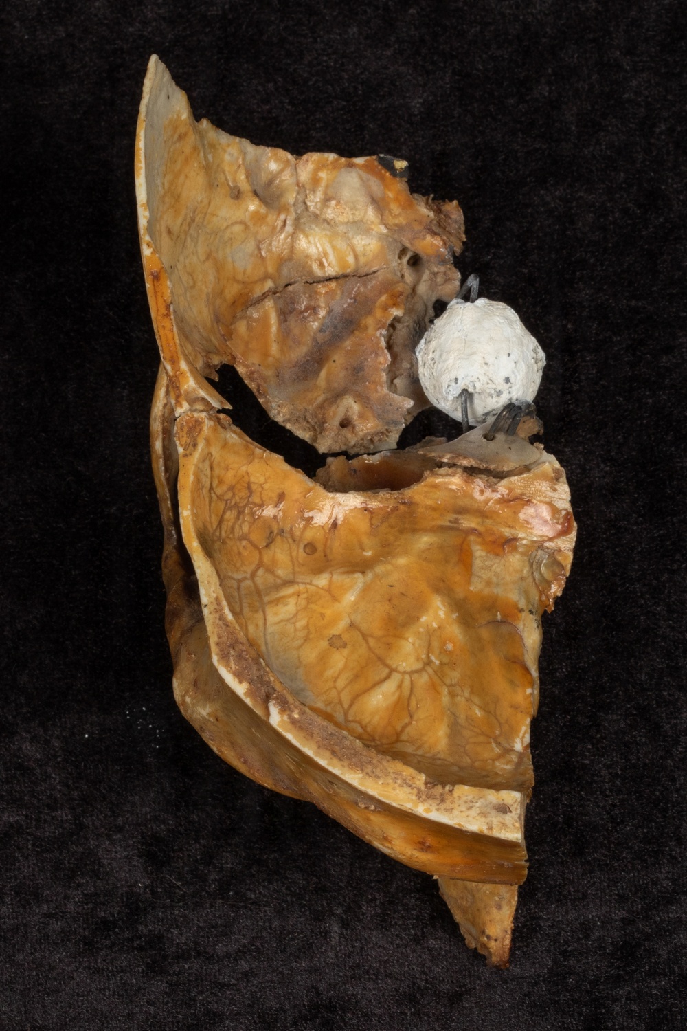 Battle of Fredericksburg Anatomical Specimen