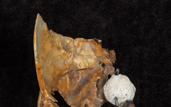 Battle of Fredericksburg Anatomical Specimen