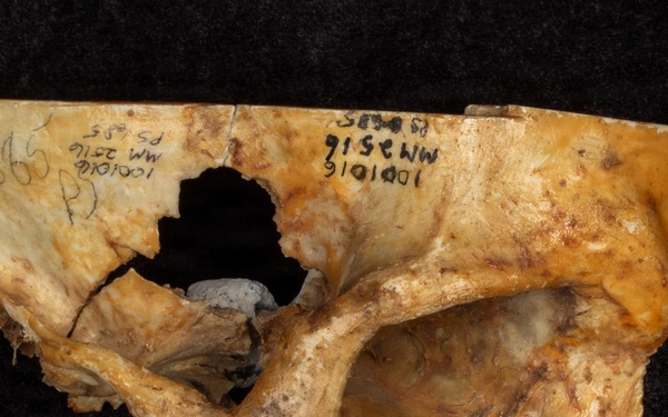 Battle of Fredericksburg Anatomical Specimen