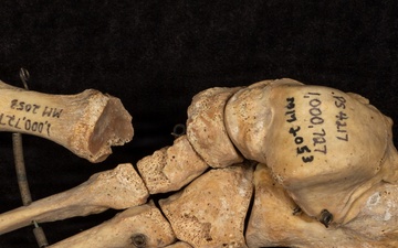 Battle of Franklin Anatomical Specimen