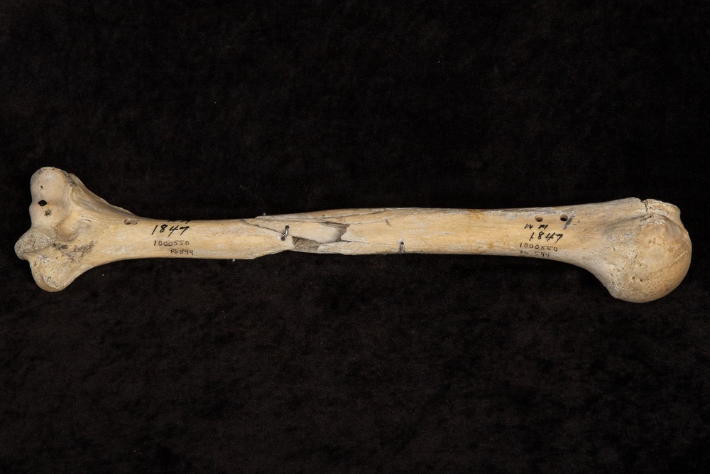 Battle of Fredericksburg Anatomical Specimen