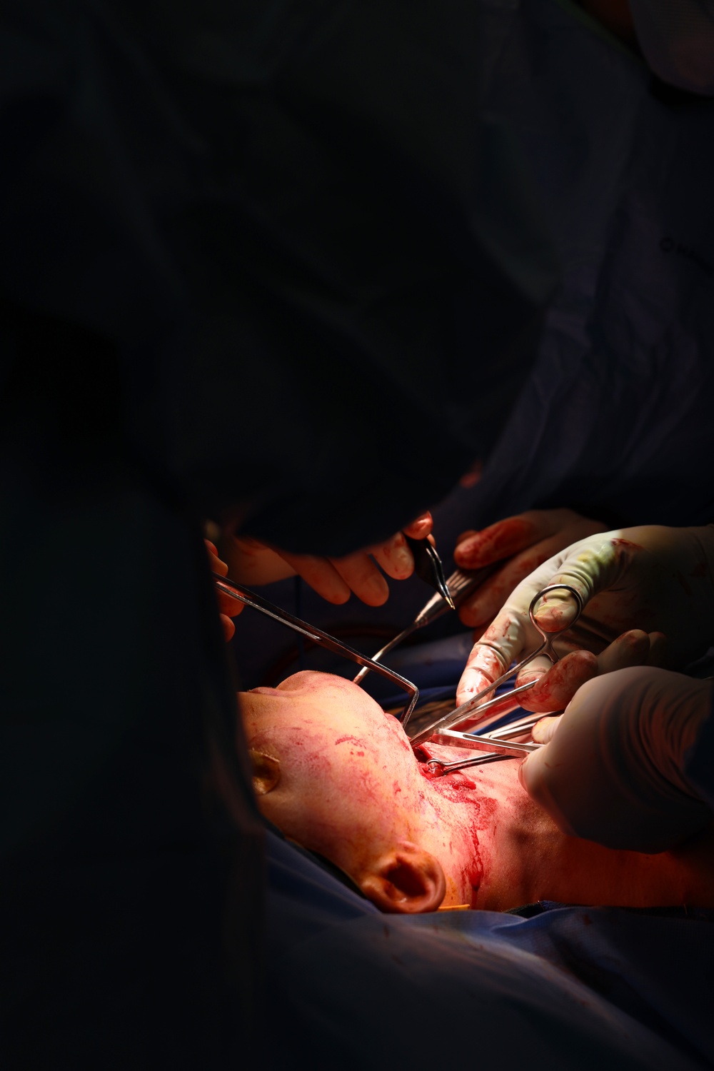 The New Face of Readiness: One Soldier’s Story of Restoration and Return to Duty