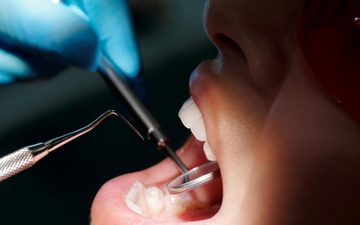 Getting care through TRICARE’s Active Duty Dental Program