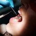 Getting care through TRICARE’s Active Duty Dental Program