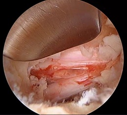 U.S. Naval Hospital Okinawa Offers New Spinal Procedure for Pain Relief