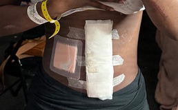 U.S. Army National Guard Soldier Saves her own life using lessons learned in Basic Combat Training