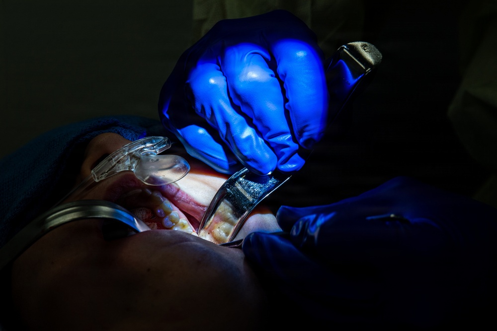Tooth Extraction in Action: The 86th Dental Squadron