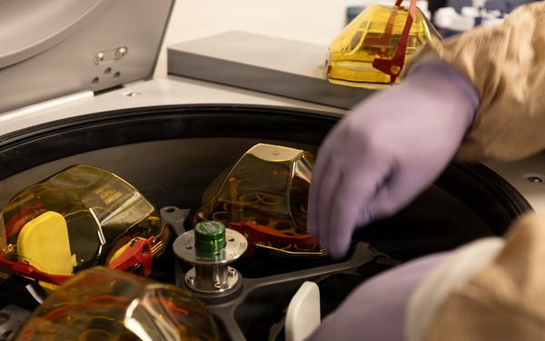 WRAIR’s SeptiBurnAlert research team reduces the time to diagnose sepsis using genomic data and AI-empowered algorithms