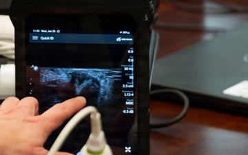 OPMED Warfighter Expeditionary Medicine and Treatment team hosts Ultrasound-Field Portable comprehensive system review