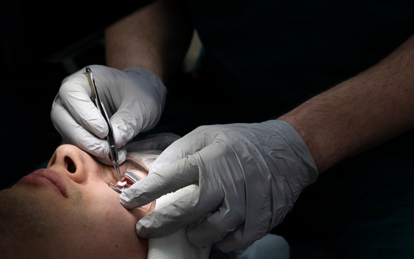 Clearing the vision barrier: Inside Walter Reed’s refractive surgery program