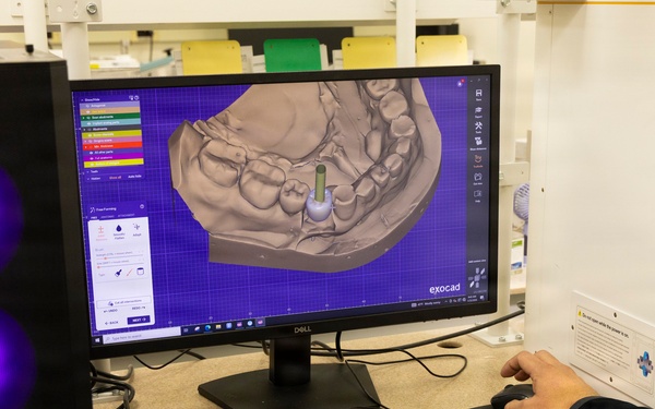 Beyond the Battlefield: The Artisans and Anaplastologists of Walter Reed