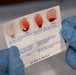 2nd Medical Battalion Hosts Joint Trauma System Trainers for Valkyrie Prehospital Transfusion Course | Eldon Blood Typing Kits, Blood Draws