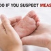 Measles - What to do if you suspect measles