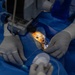 Guyana, U.S. Air Force medical teams deliver specialized eye care during LAMAT 2026
