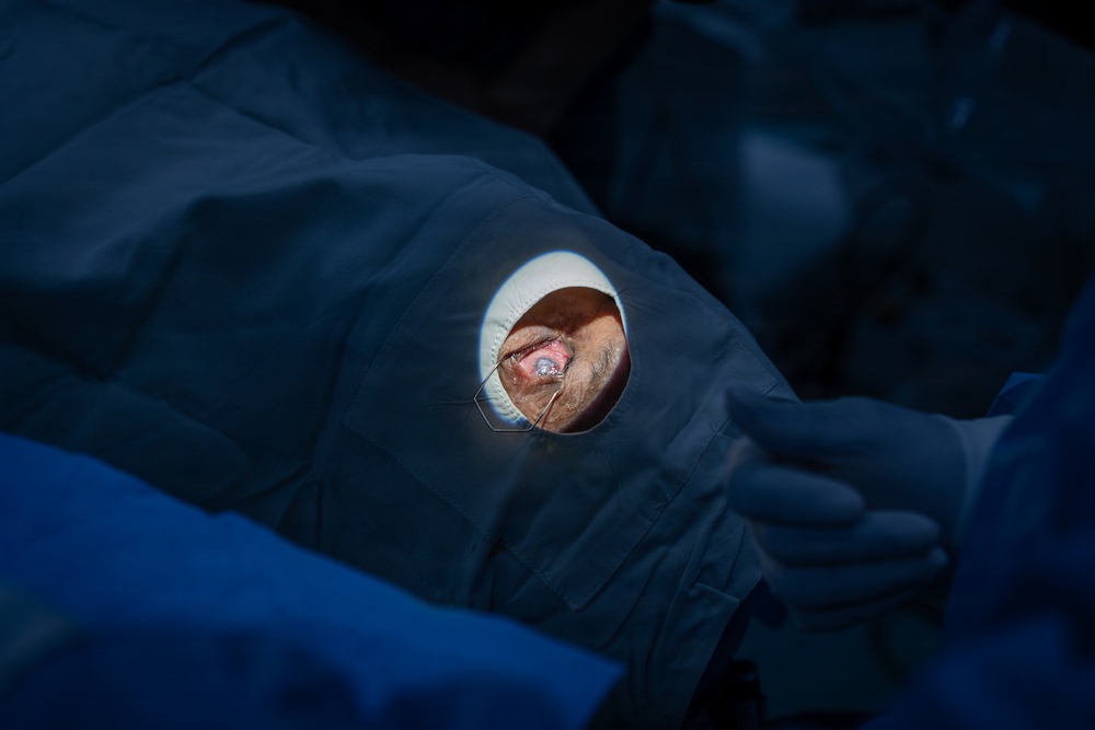 Guyana, U.S. Air Force medical teams deliver specialized eye care during LAMAT 2026