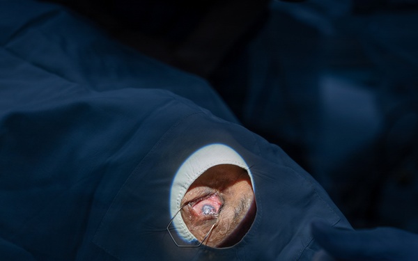 Guyana, U.S. Air Force medical teams deliver specialized eye care during LAMAT 2026