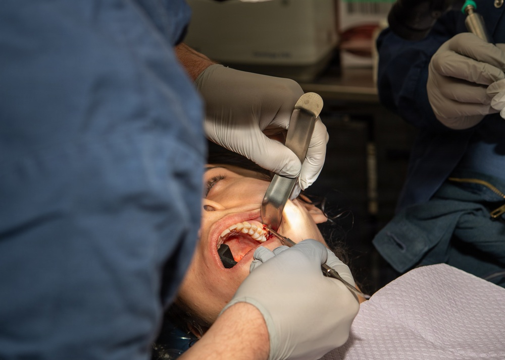 IKE Dental Performs Oral Surgery