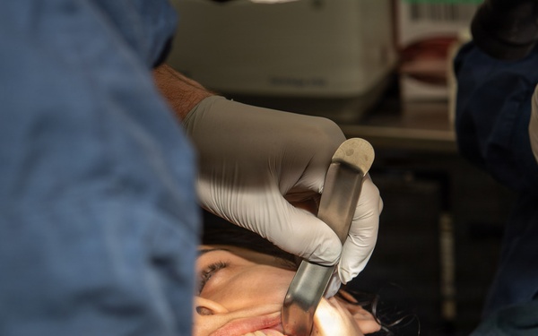 IKE Dental Performs Oral Surgery