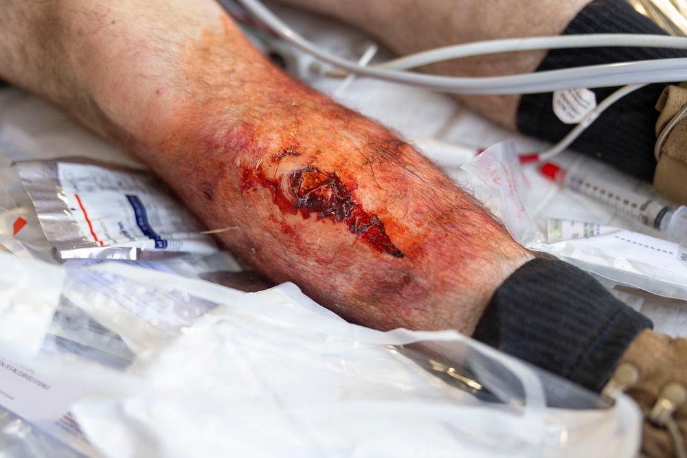 2nd Medical Battalion Certification Exercise