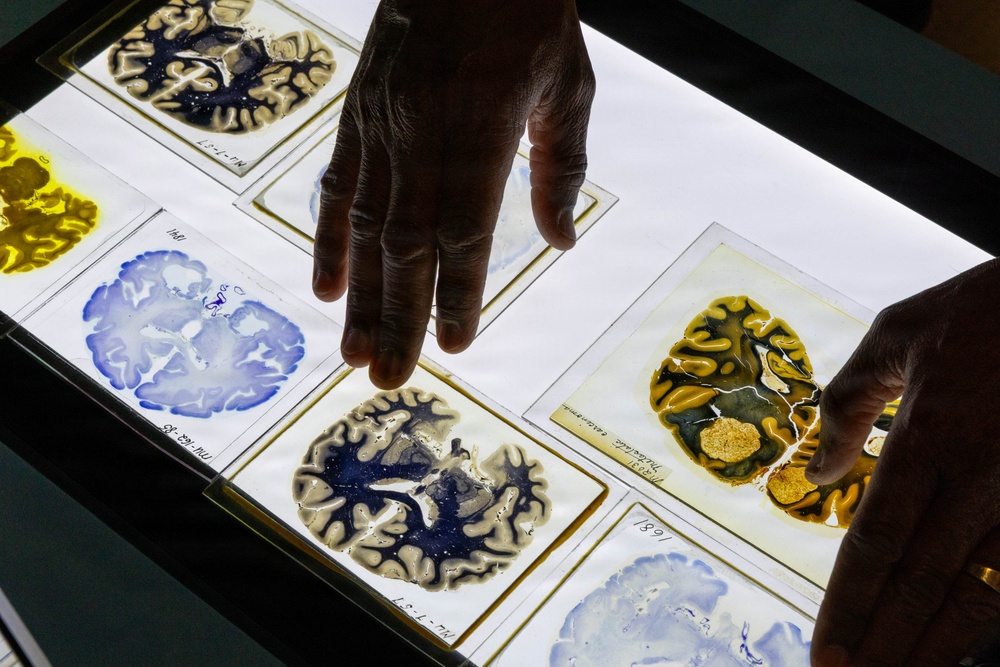 NMHM Brain Awareness Day 2026