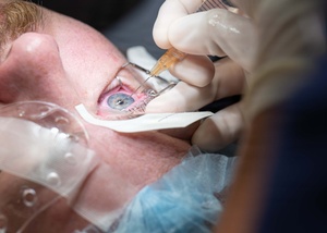 LRMC Refractive Eye Surgery (RADIO)