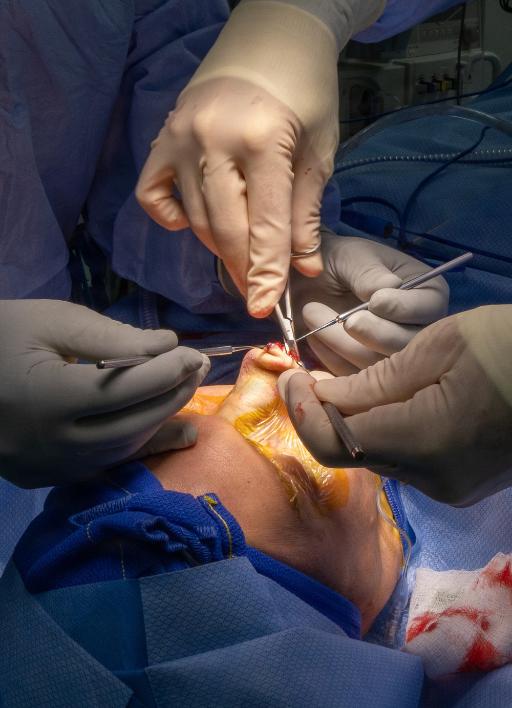 USNH Yokosuka expands elective facial surgery access, strengthening readiness and patient care