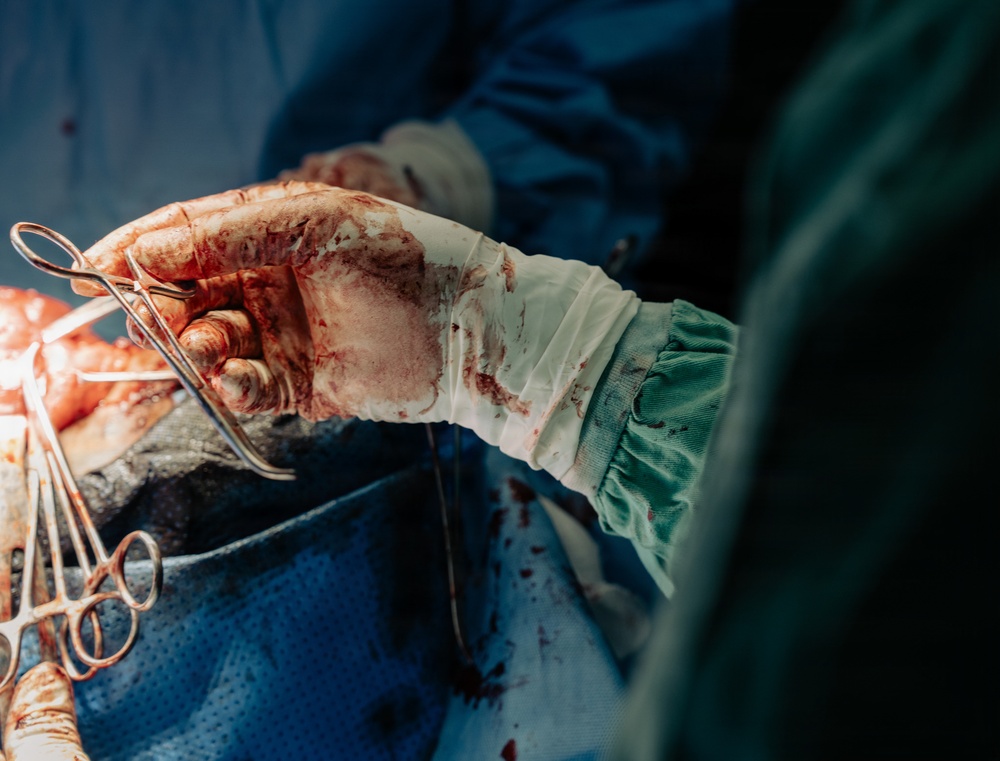 US, Senegal conduct thyroid surgeries during African Lion 2026