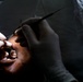 US, Ghana treat dental patients during AL26 MEDREX