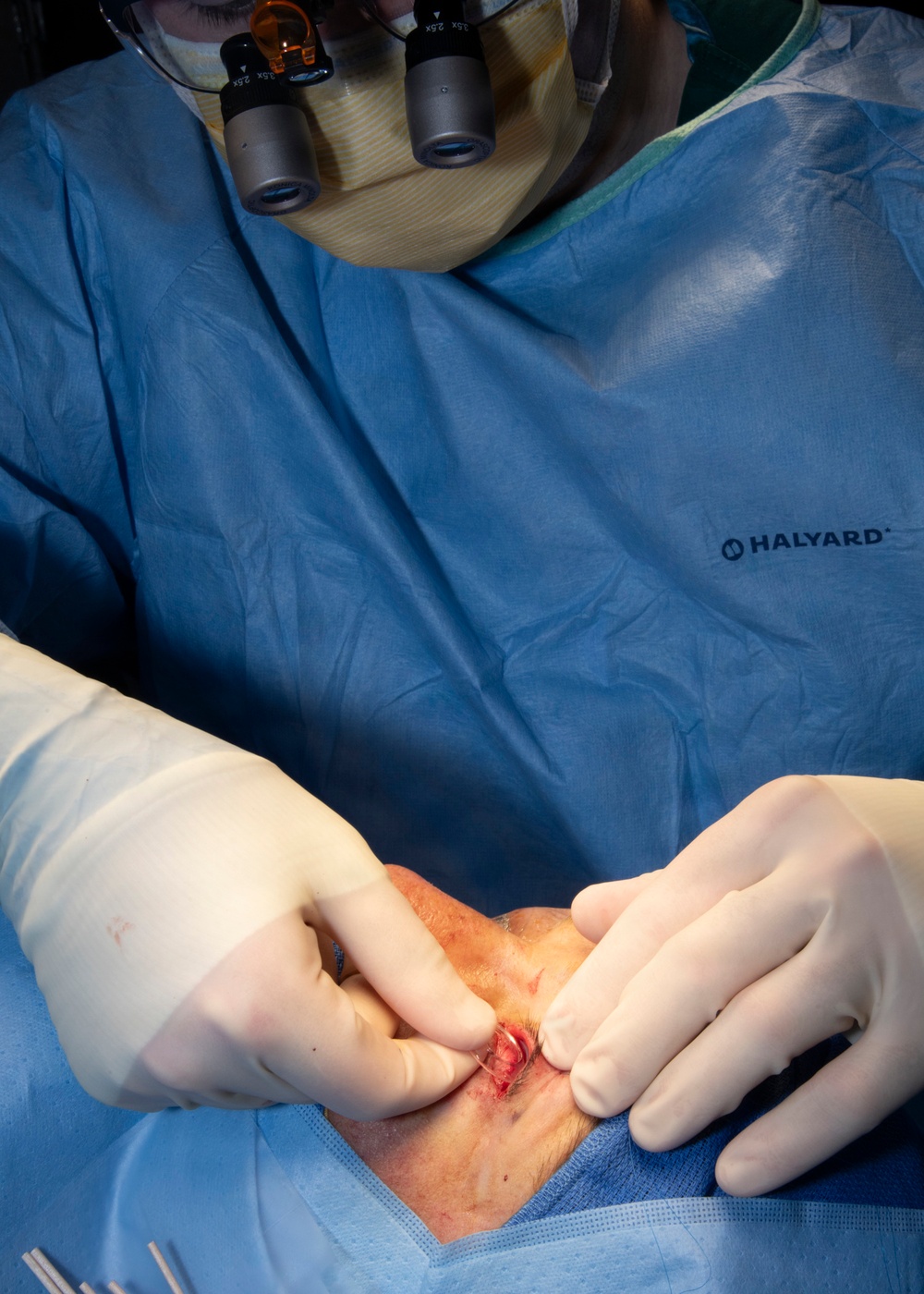 Seeing the Unseen: Navy Eye Care Specialists Target Preventable Blindness with Early Detection
