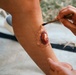 U.S. Soldiers participate in a mass casualty exercise during RIMPAC 2026