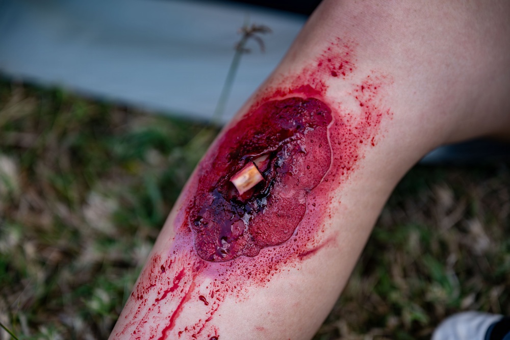 U.S. and foreign allies moulage simulated patients in joint mass causality Medevac drills on Ford Island