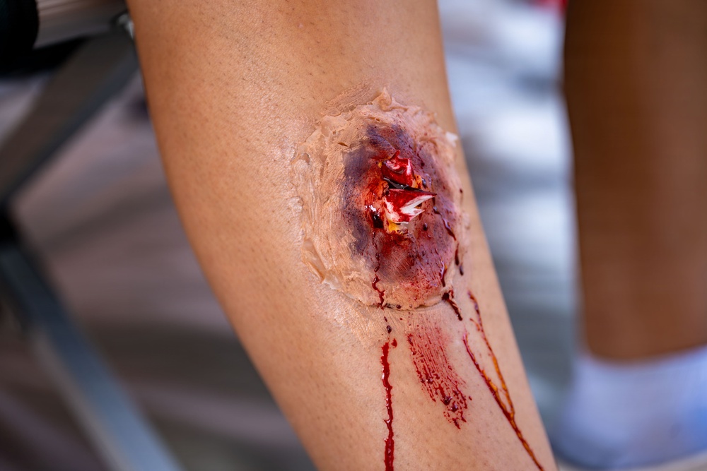 U.S. and foreign allies moulage simulated patients in joint mass causality medevac drills on Ford Island