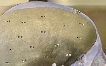 A perfect fit: Walter Reed becomes first point-of-care facility to receive FDA clearance for patient-specific implant