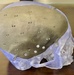 A perfect fit: Walter Reed becomes first point-of-care facility to receive FDA clearance for patient-specific implant
