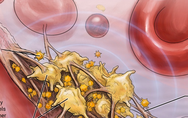DARPA program: RAPIID - synthetic platelets
