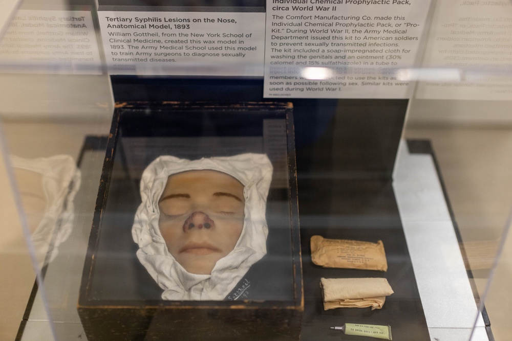 Syphilis Exhibit