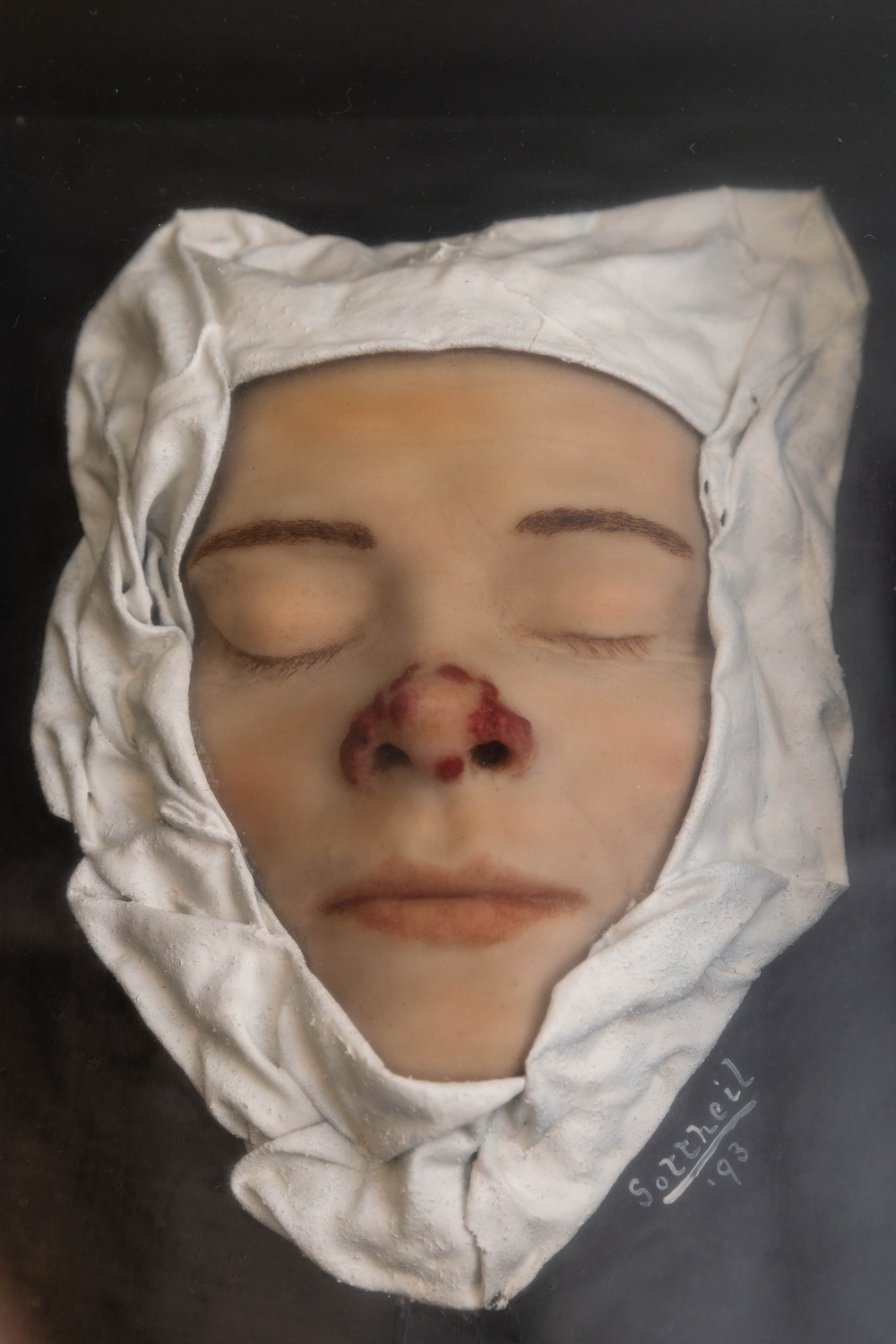 Syphilis Exhibit