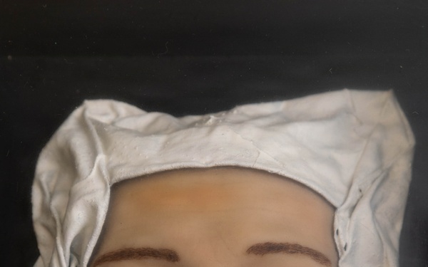 Syphilis Exhibit