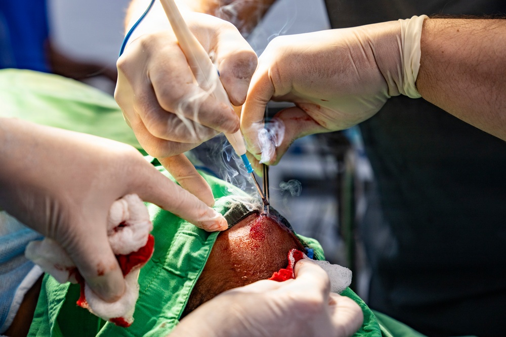 Shared expertise strengthens health security during Amistad 2026