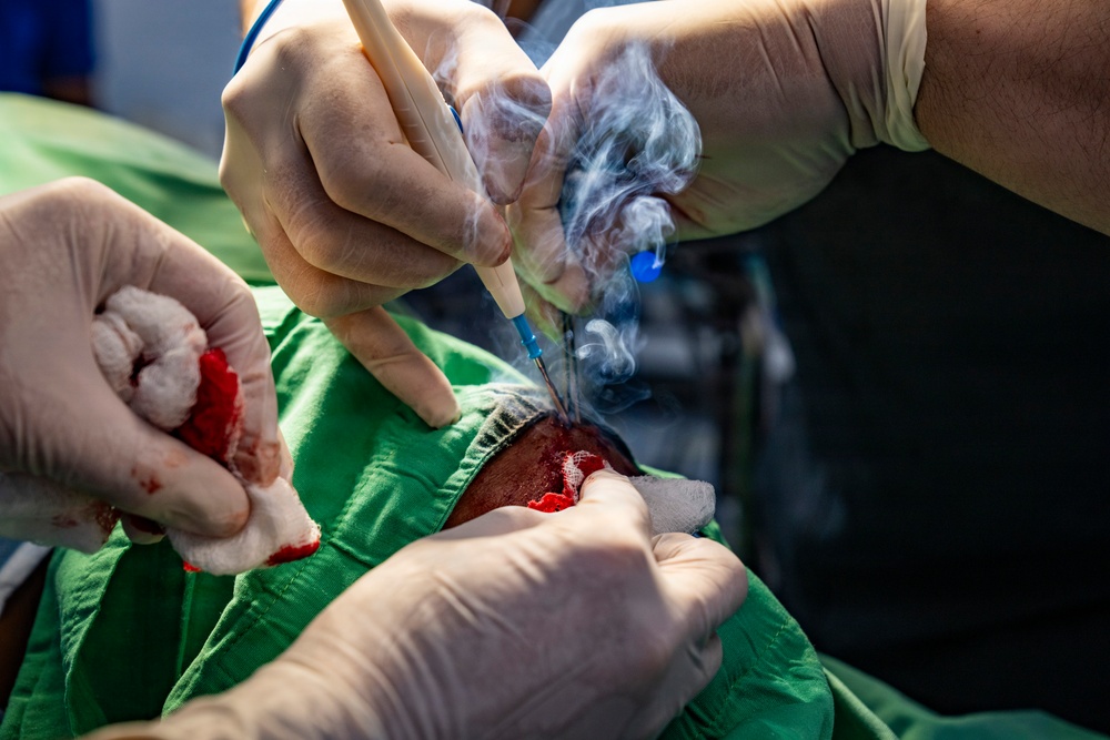 Shared expertise strengthens health security during Amistad 2026