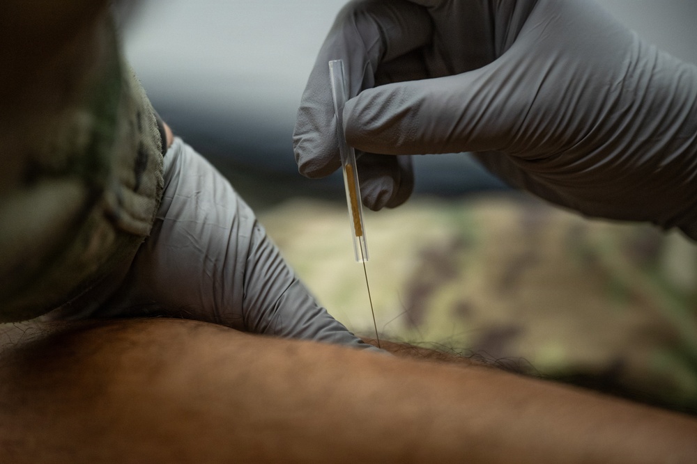 Early action helps Airmen stay ahead of injury