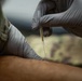 Early action helps Airmen stay ahead of injury