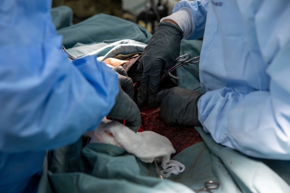 The image depicts a surgical procedure in progress, with multiple medical personnel working on a patient. At least two individuals wearing blue surgical gowns and black nitrile gloves are visible, using surgical instruments including hemostatic clamps/scissors. Surgical drapes, gauze, and visible blood indicate an active operative field.