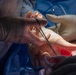 Surgical Operation performed aboard USS Makin Island