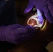 A dental professional wearing purple nitrile gloves is performing an oral examination on a patient whose mouth is wide open. A light source is being used to illuminate the oral cavity, allowing visibility of the teeth and soft tissues. The image is taken from a close-up overhead angle in a dimly lit clinical setting.