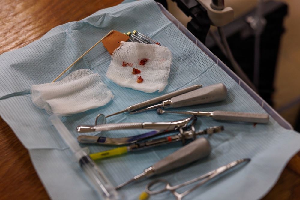 A dental procedure tray is shown post-operation, containing various used dental instruments laid out on a sterile blue drape. Gauze pads are visible, one of which contains small bloody tissue fragments, indicating a recent tooth extraction or oral surgery procedure. The tray includes a variety of stainless steel dental tools alongside a syringe and color-coded instruments.