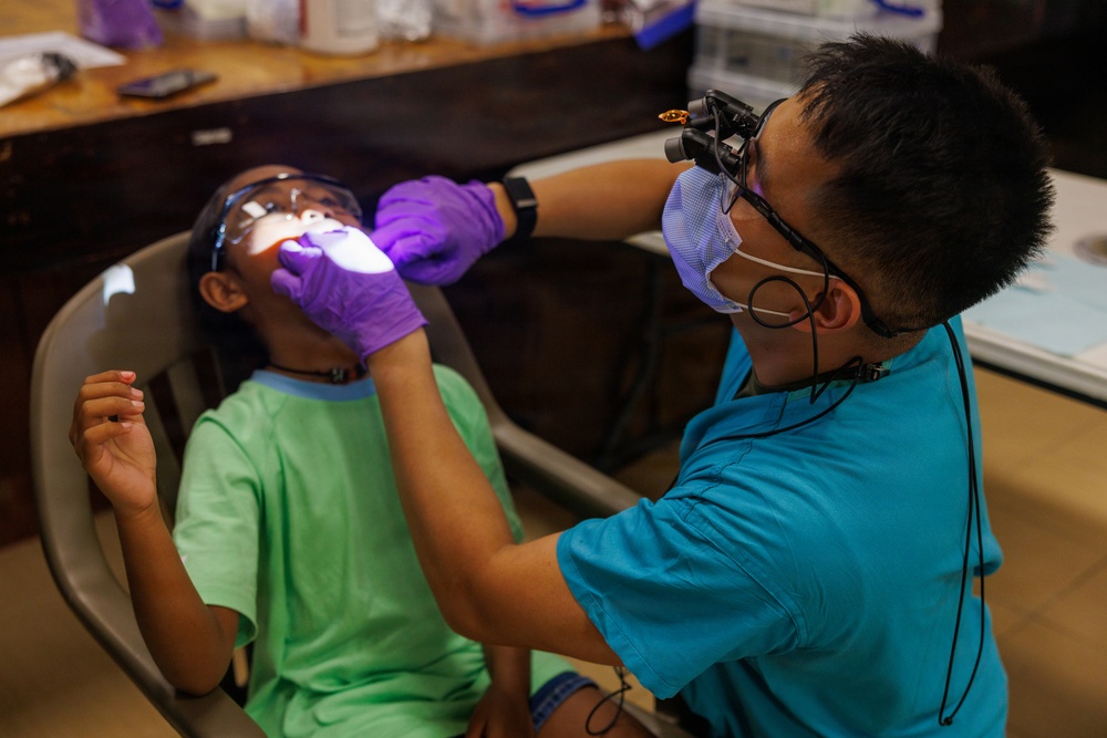 A dental professional is examining a young child's mouth in what appears to be a field or community dental clinic setting. The dentist is wearing protective gear including loupes, a face mask, and purple nitrile gloves, and is using a light to illuminate the child's oral cavity. The child, wearing a green t-shirt, is reclined in a chair with protective eyewear on.