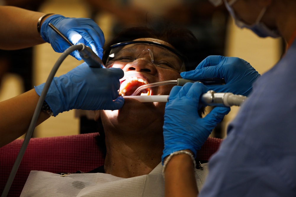 A dental patient is reclined in a dental chair with their mouth open, receiving treatment from two dental professionals. Both practitioners are wearing blue nitrile gloves and are using dental instruments including a suction device and a dental tool with a light. The patient is wearing protective eyewear and a dental bib.