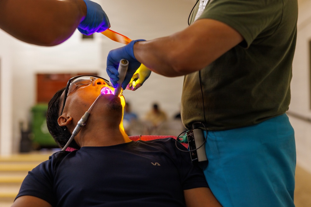 A dental procedure is being performed on a reclined patient wearing protective eyewear. A dental professional wearing blue gloves is using a UV curing light inside the patient's open mouth, likely curing a dental composite or sealant. The setting appears to be a community health clinic or field dental outreach event.